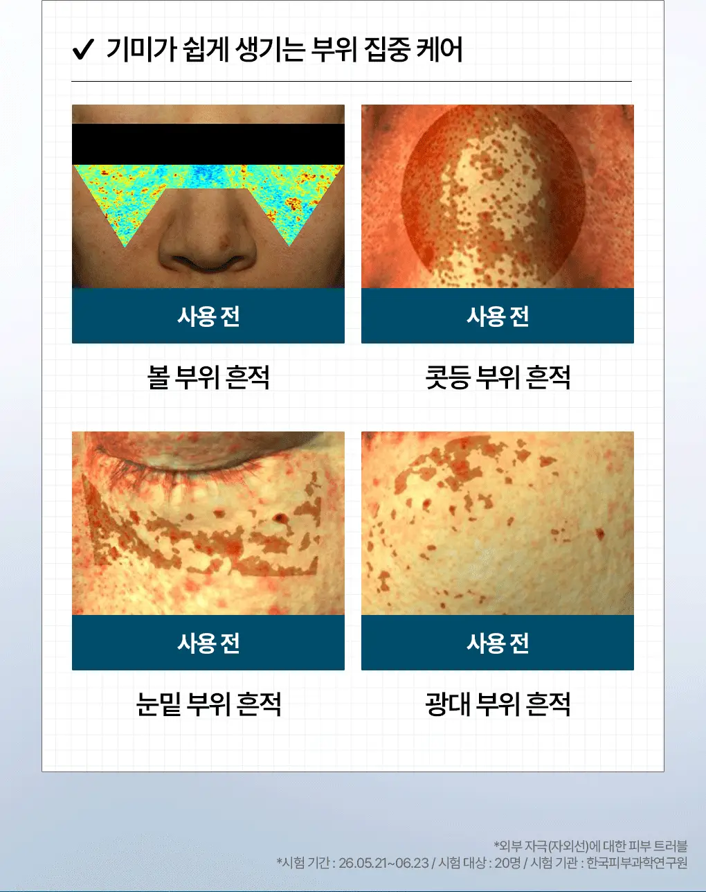 [업그레이드 수분흔적세럼/1+1] 메디힐 마데카소사이드 더마 세럼 50+50mL 기획 상세페이지 13